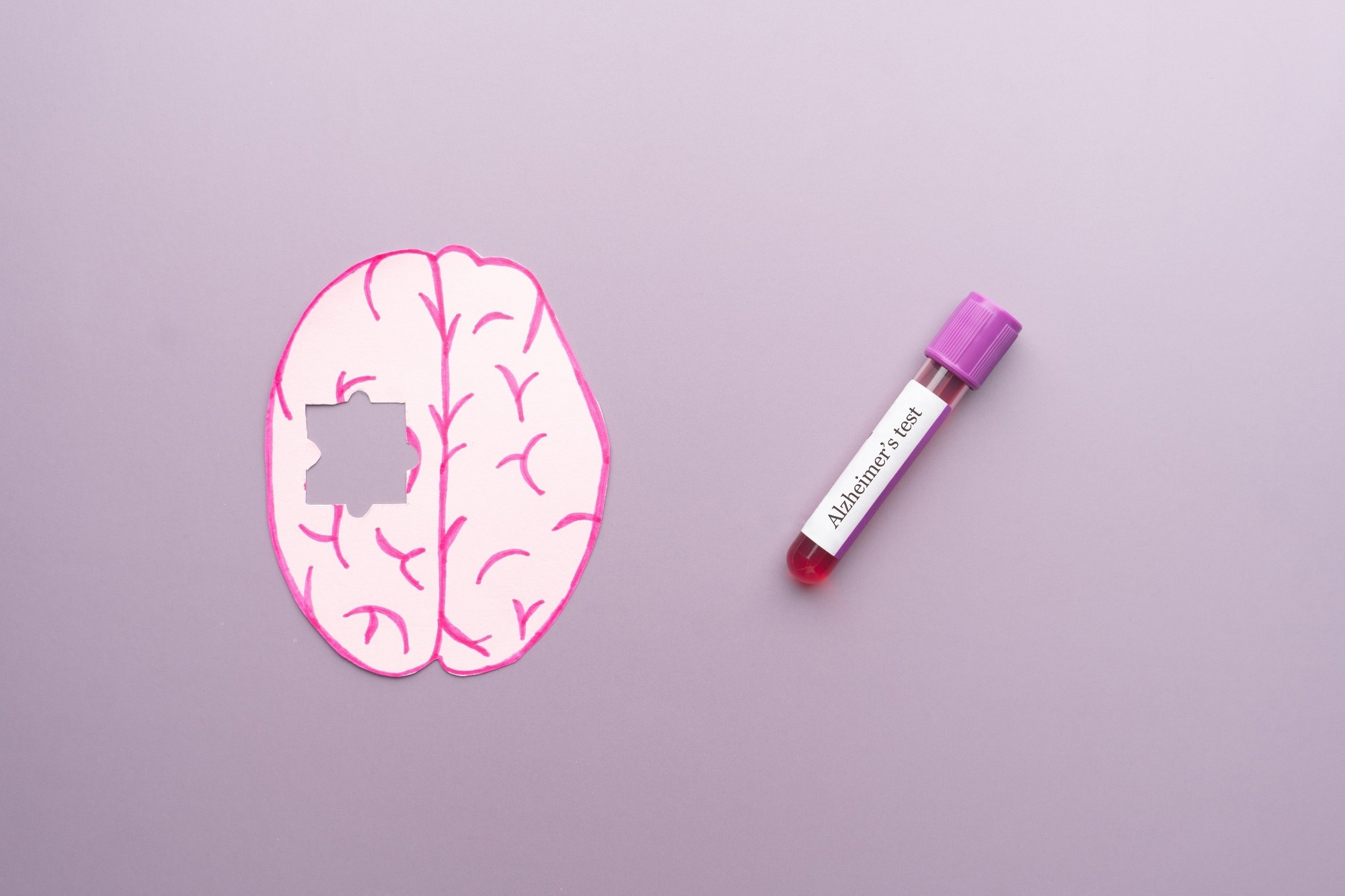 A study links a blood protein to memory and brain changes in Down syndrome
