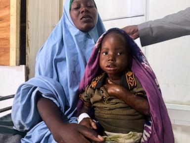 Mother’s 3-day walk with sick child highlights Somalia’s child malnutrition emergency