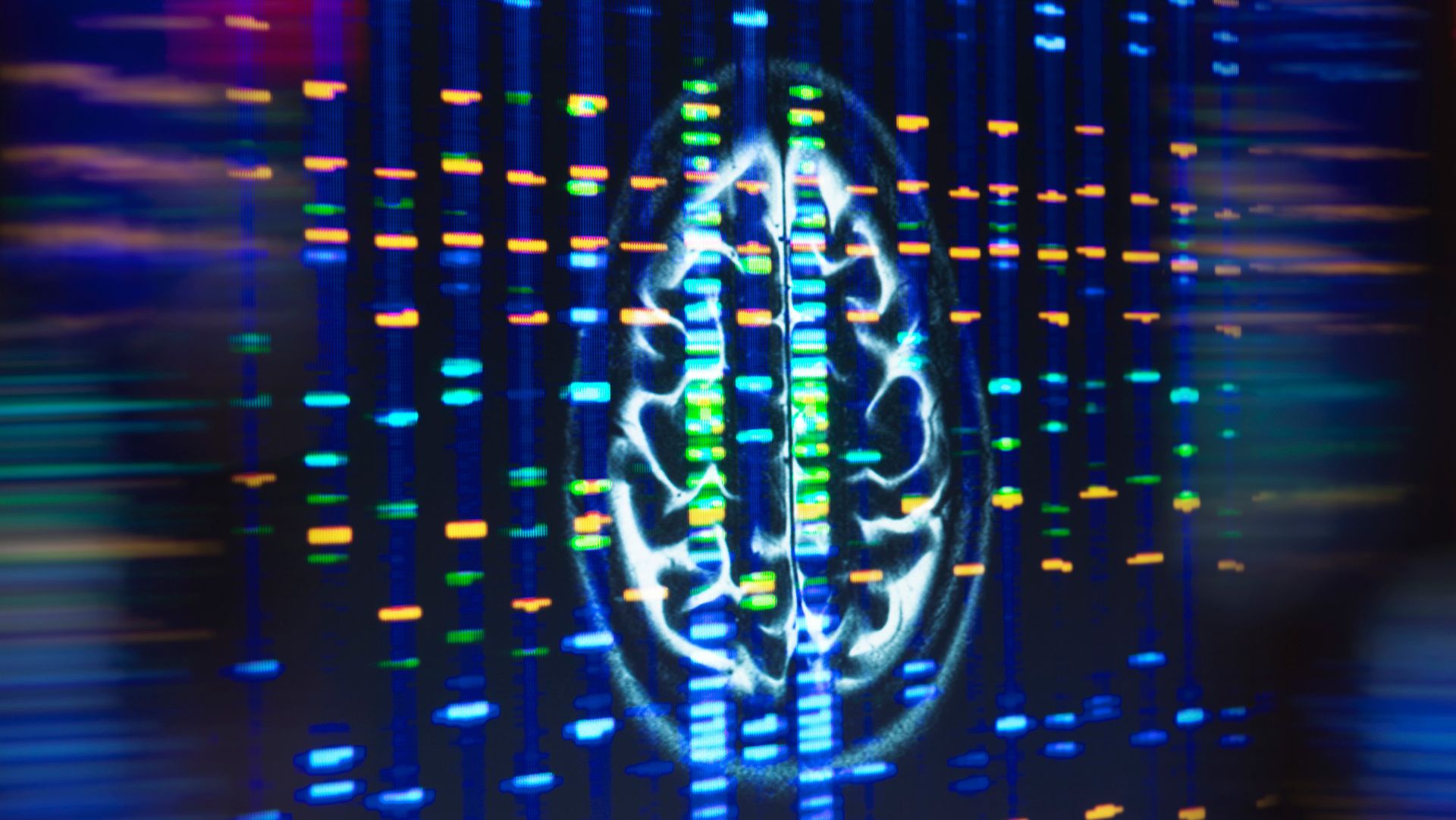 A gene variant triples the risk of getting Alzheimer’s disease — fat buildup in brain cells may be to blame, study finds