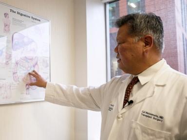 How the US organ transplant system works and what to ask to improve your chances