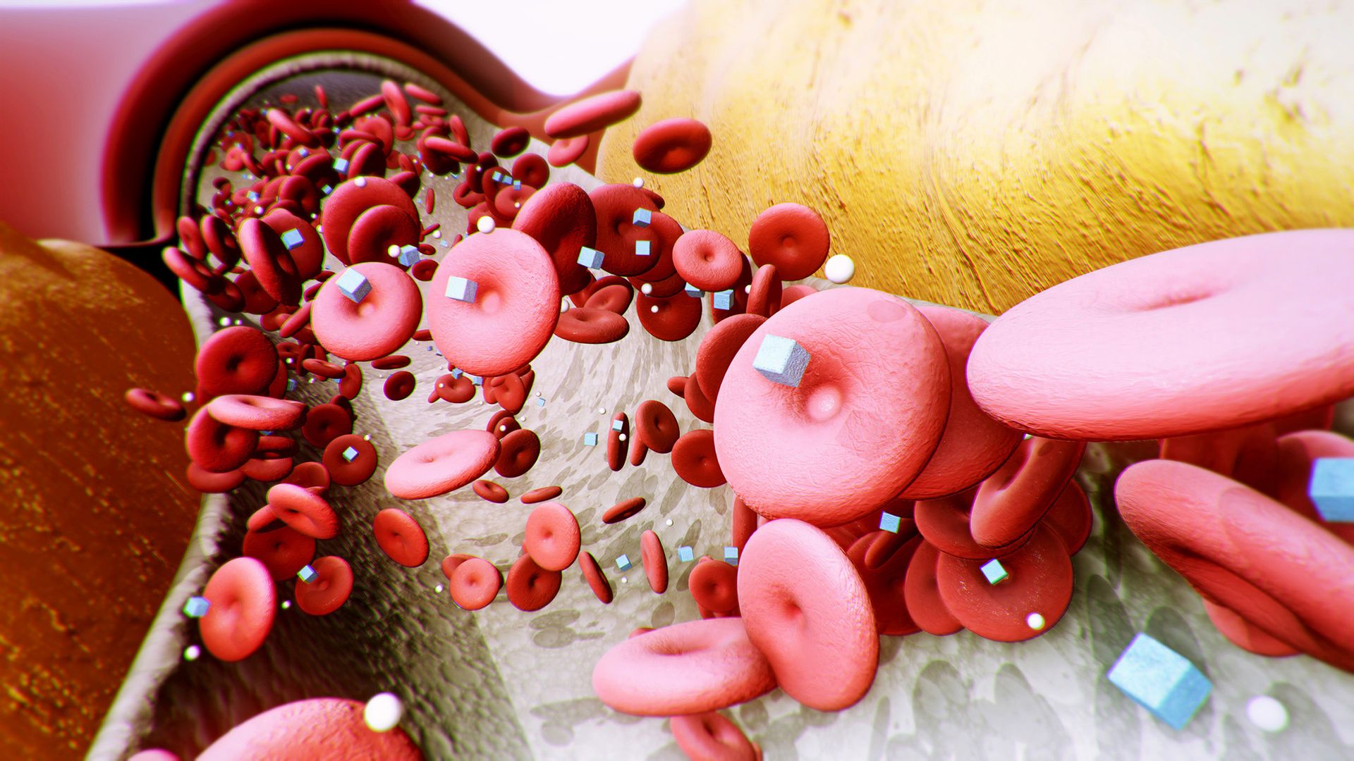 Scientists invent implant that can transform sugar in the blood to treat type 2 diabetes