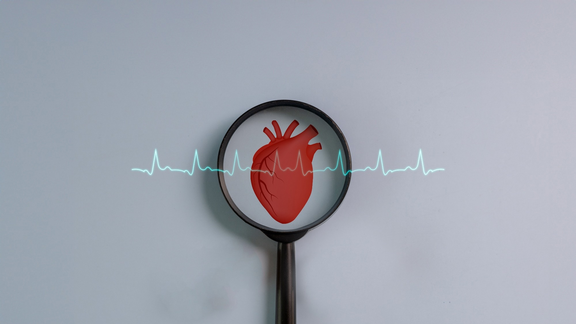 Low vitamin B12 is linked to heart disease. Supplements tell a different story